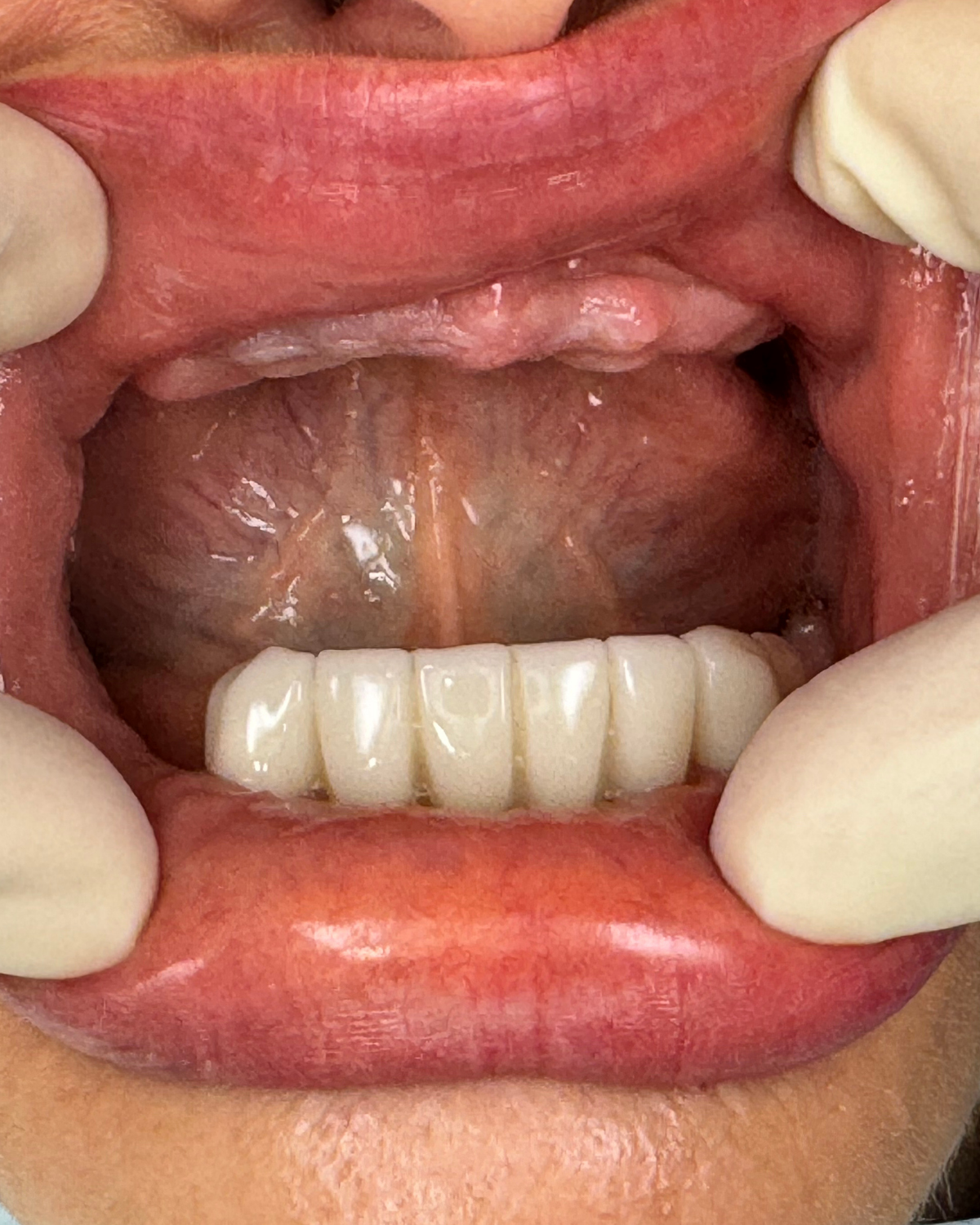 Zubní vyšetření — Estoma Clinic