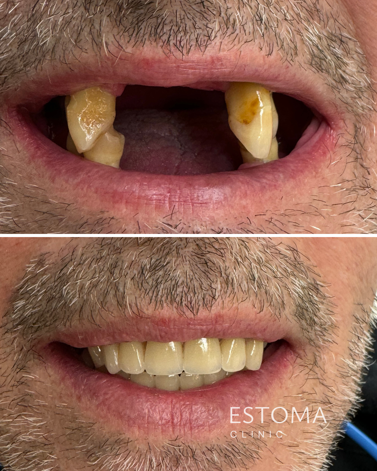 Kvalita života a zdravé zuby — Estoma Clinic