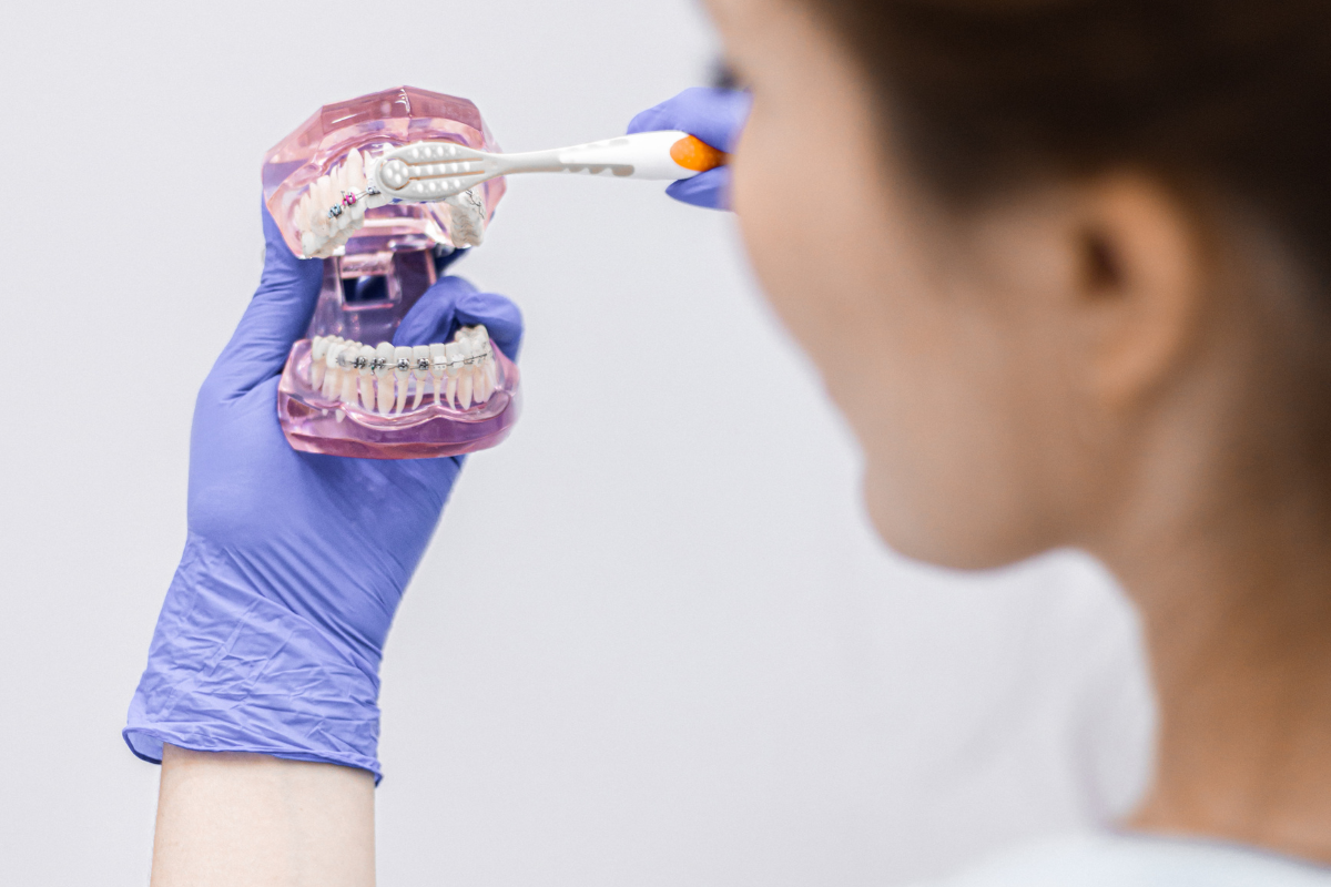 Proč je profesionální dentální hygiena klíčová pro prevenci zubního kazu a paradentózy