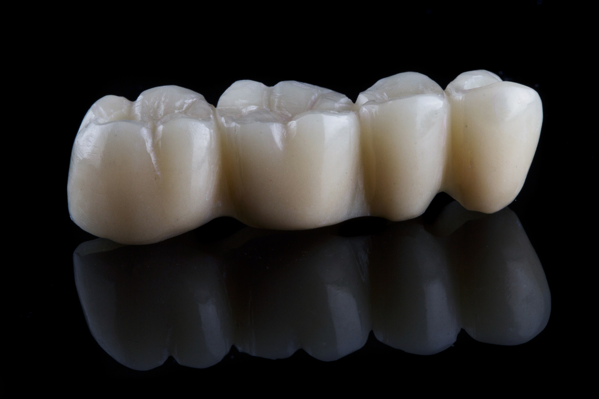 Materiály zubních můstků – který je pro vás ten pravý?