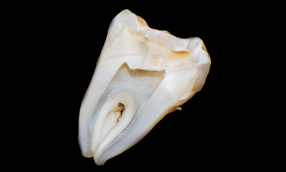 Struktura zubu - sklovina a dentin