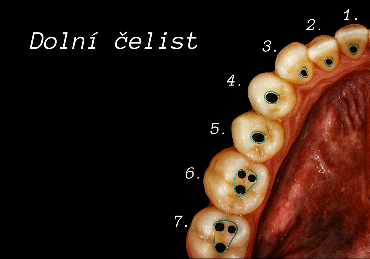 Anatomie dolní čelisti