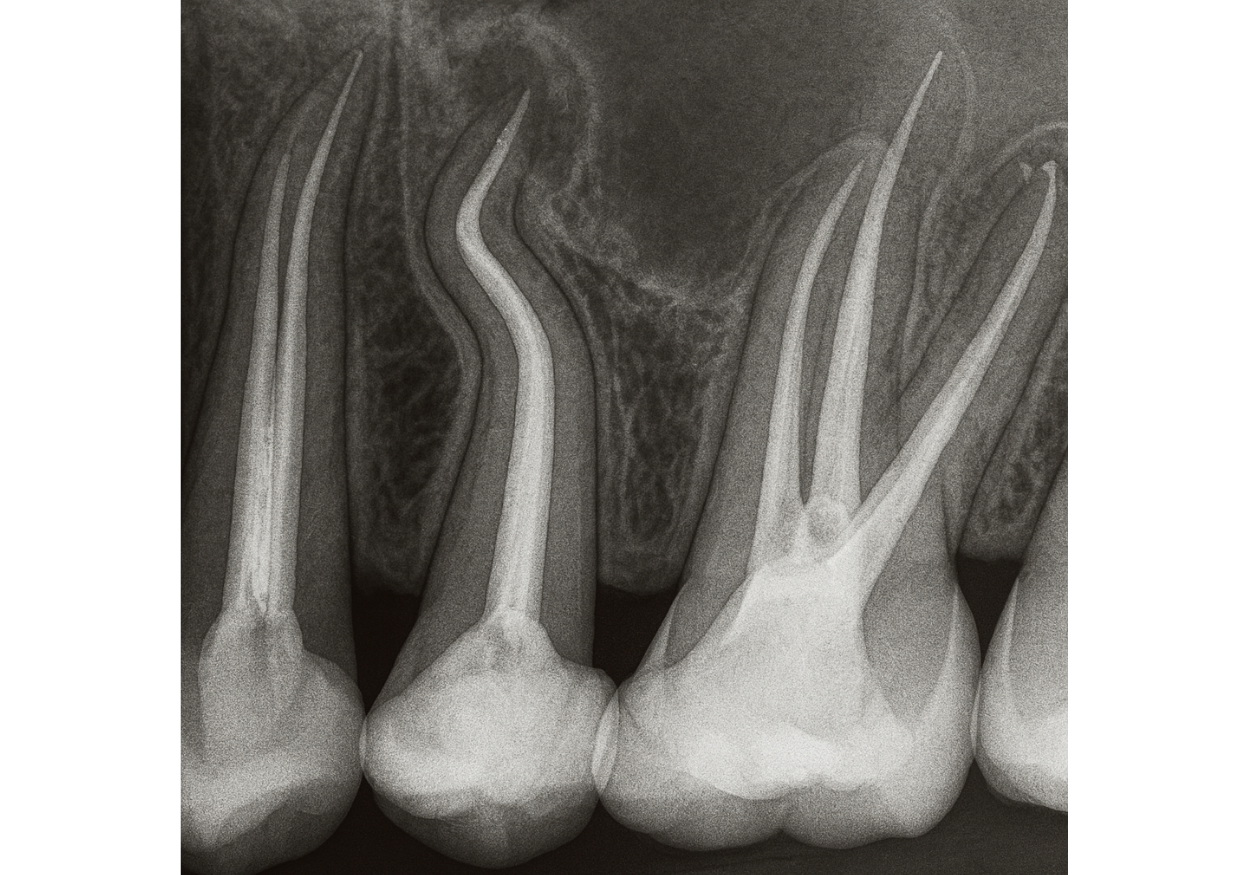Anatomie kořenových kanálků podle studií