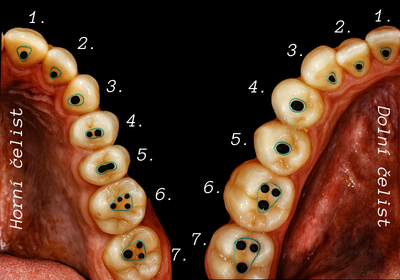 Anatomie kořenových kanálků zubu — Estoma Clinic