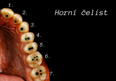 Anatomie kanálků horní čelisti — Estoma Clinic