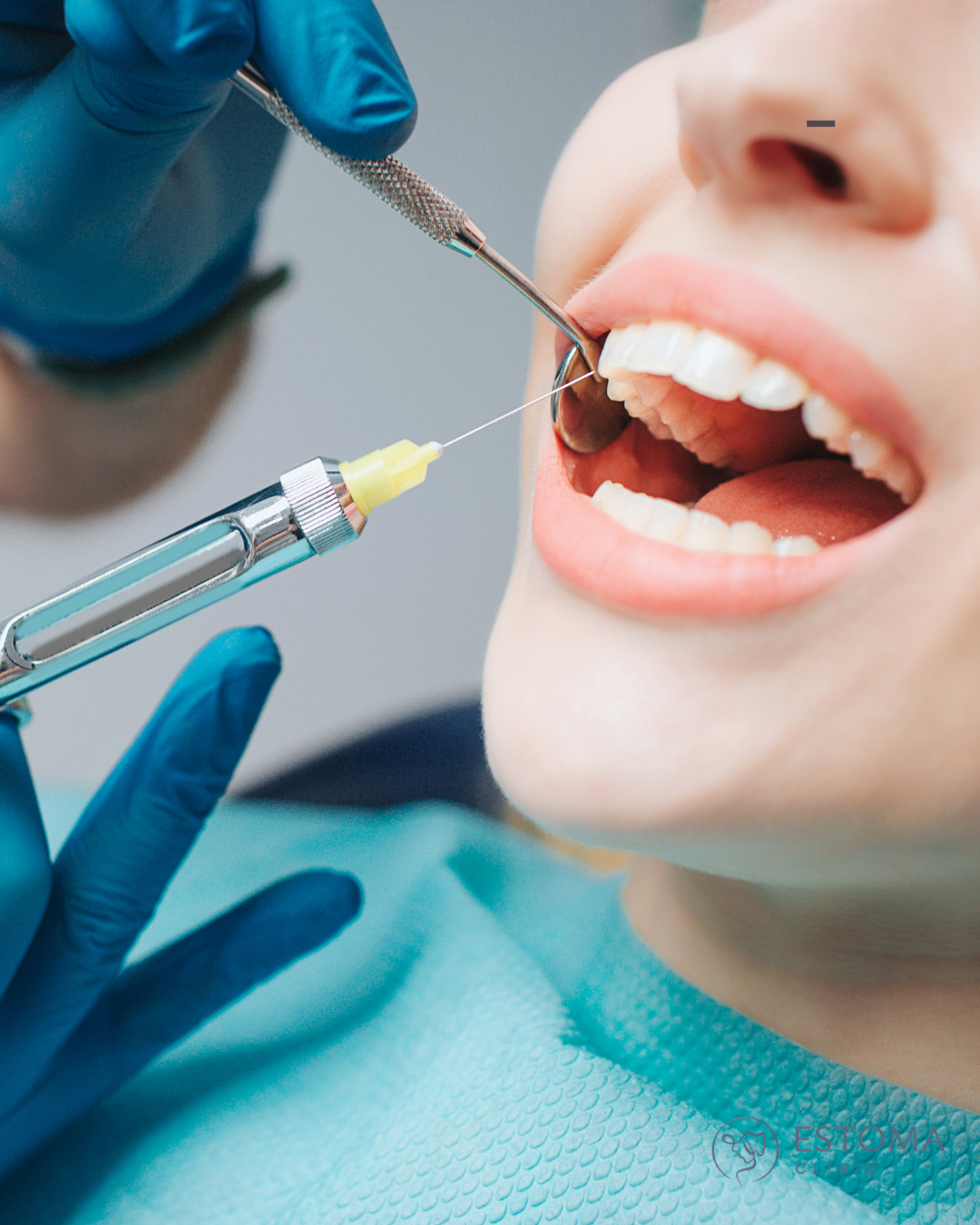 Zubní ošetření v Estoma Clinic
