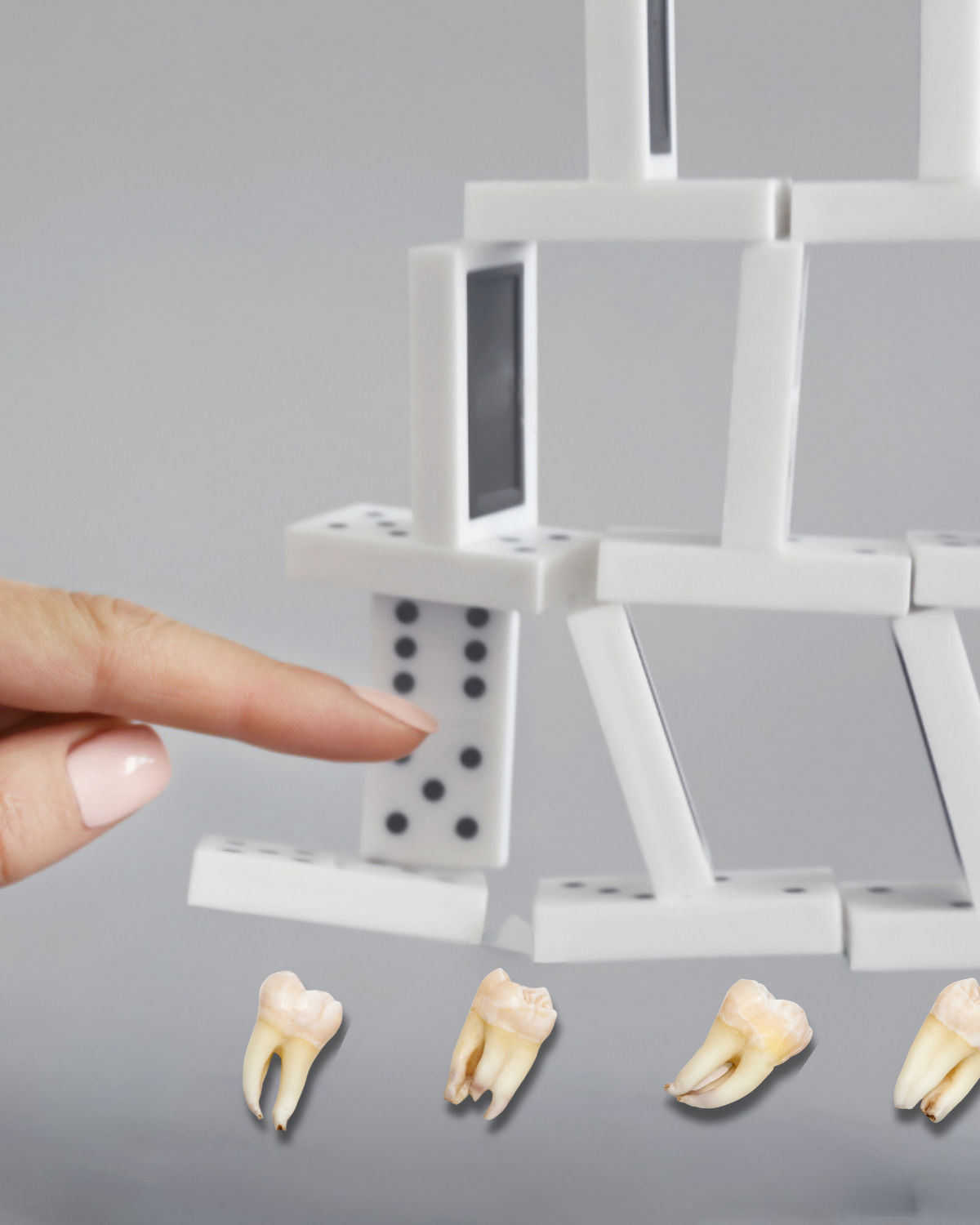 Domino efekt ztráta zubů — Estoma Clinic