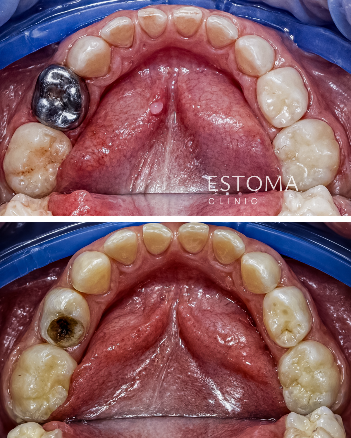 Dítě u zubaře — Estoma Clinic