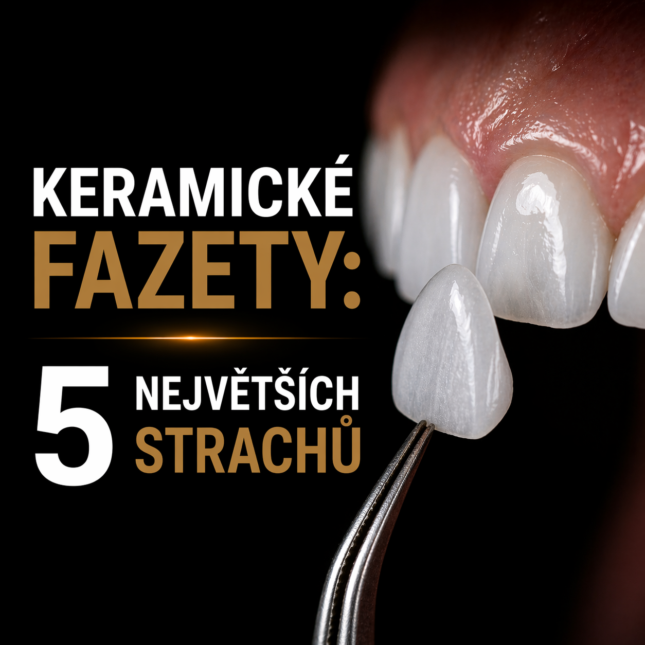 Keramické fazety: 5 největších strachů, které už nemusíte mít