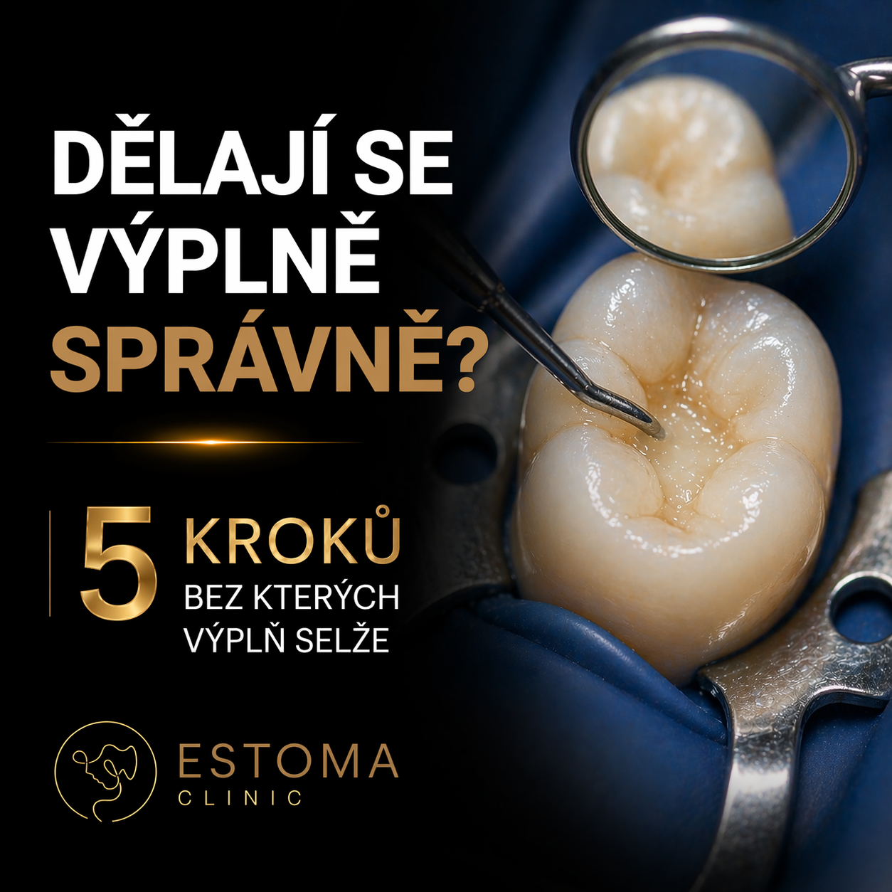 5 kroků výplňového protokolu – a proč je nevynechat