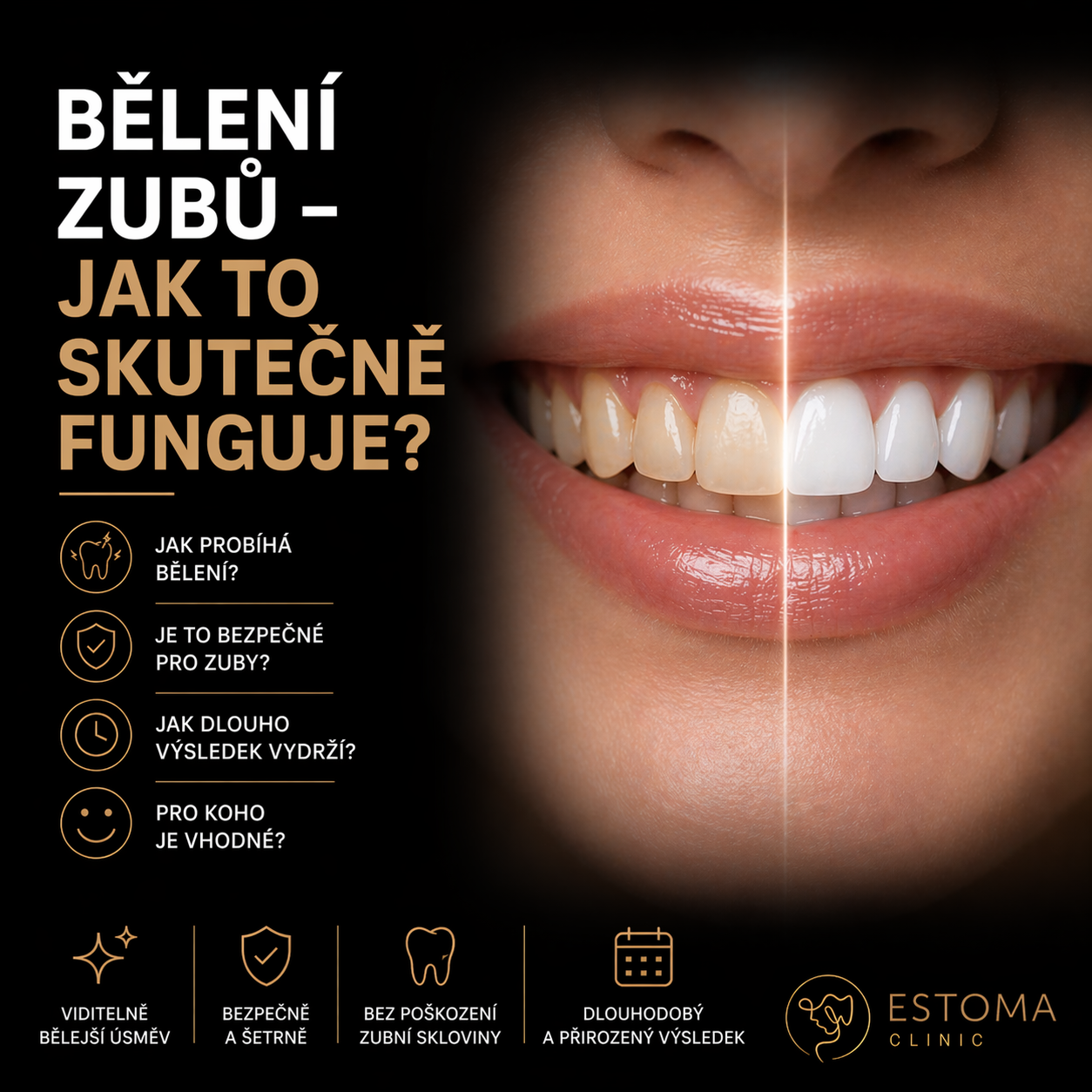 Bělení zubů – jak to skutečně funguje?