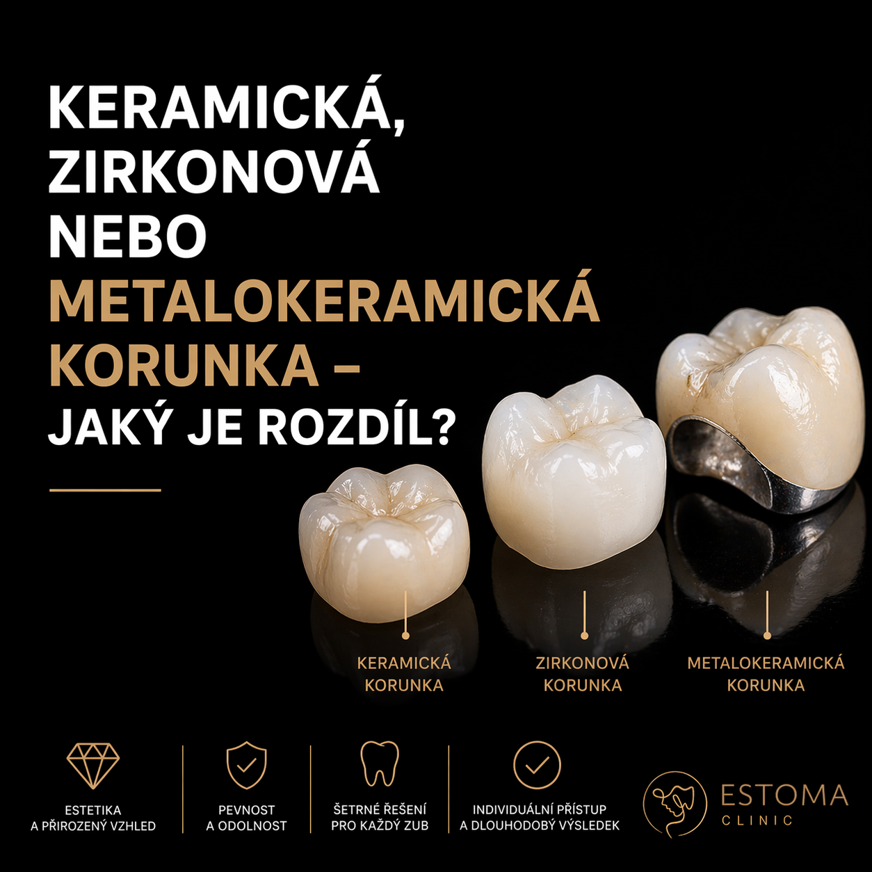 Keramická, zirkonová nebo metalokeramická korunka – jaký je rozdíl?
