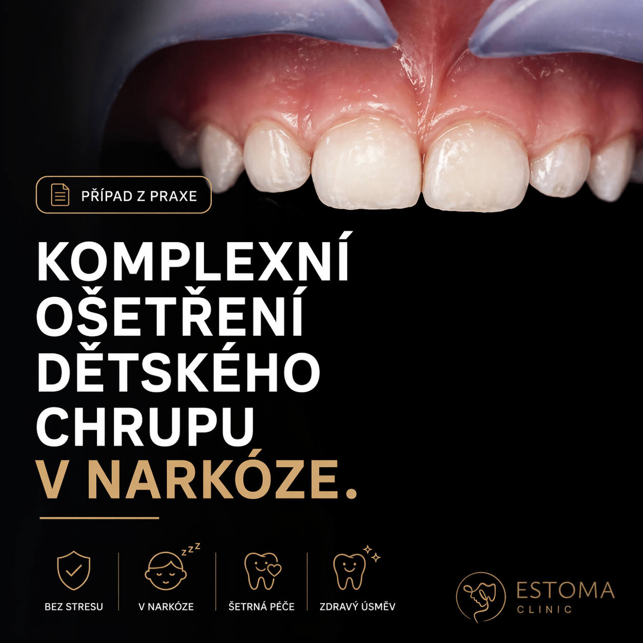 Případ z praxe: Komplexní ošetření dětského chrupu v narkóze.