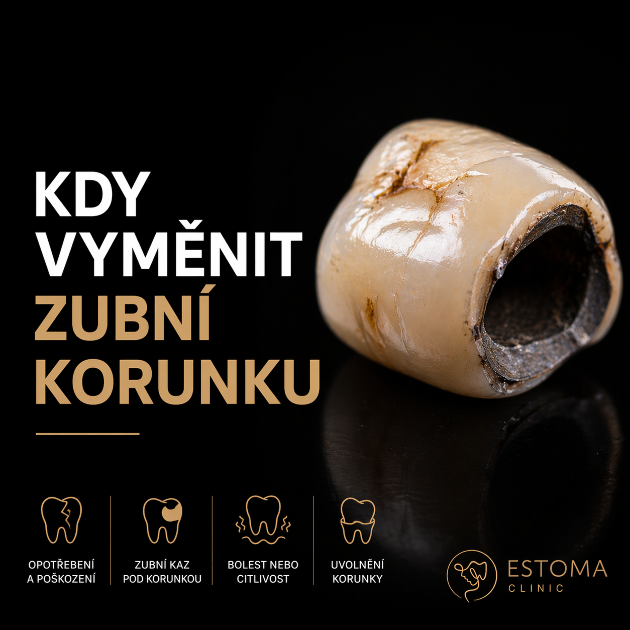 Kdy vyměnit zubní korunku