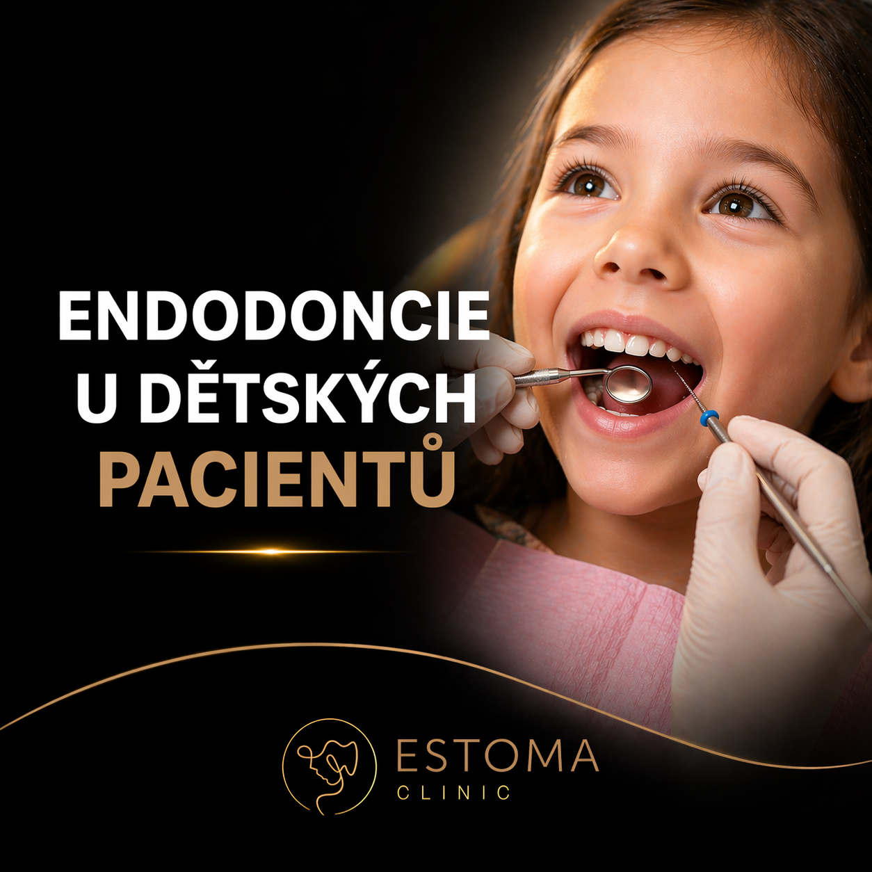 Endodoncie u dětských pacientů: kořenové kanálky u dětí
